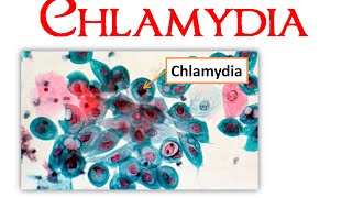 Chlamydia [upl. by Alletnahs]