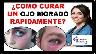 💡 COMO CURAR UN OJO MORADO  3 pasos para tratar y eliminar Moretones o Hematoma facial 2021 ✅ [upl. by Neeka]