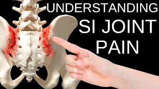 Simple Solutions to Sacroiliac SI Joint Pain [upl. by Willms]