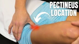 Pectineus Muscle Strain Location  Anterior Hip Pain Running [upl. by Esinereb699]