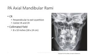 Radiographic Positioning of the Mandible [upl. by Dulcinea]