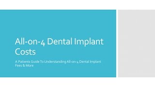 All on 4 Dental Implant Costs [upl. by Kcirde]