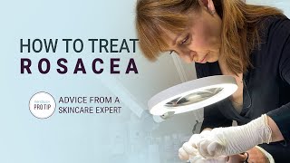 How to Treat Rosacea  Advice from a Skincare Expert [upl. by Irual234]