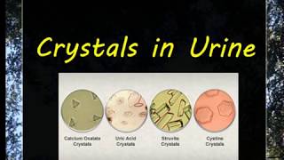 Urine Examination3 Crystals [upl. by Nyad]