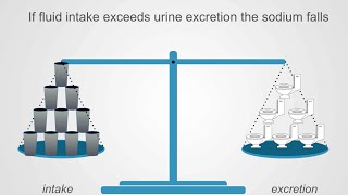 Hyponatremia Basics Understanding Water Intake amp Urine Output [upl. by Linzer]