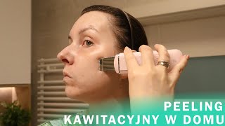 PEELING KAWITACYJNY W DOMU  CENA ZALETY EFEKTY [upl. by Schwenk219]