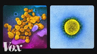 What the coronavirus looks like up close [upl. by Fabien]