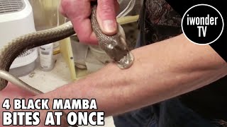 Surviving A Black Mamba Snake Bite  Venom Man [upl. by Malinowski91]