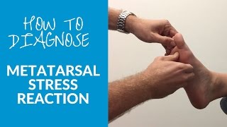 How to diagnose metatarsal stress reaction and fracture [upl. by Nhguavad]