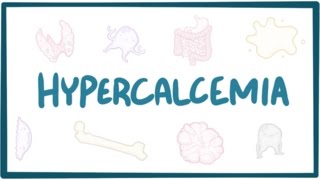 Hypercalcemia  causes symptoms diagnosis treatment pathology [upl. by Alita]