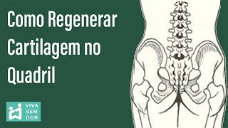 Como regenerar cartilagem no quadril [upl. by Eecram]