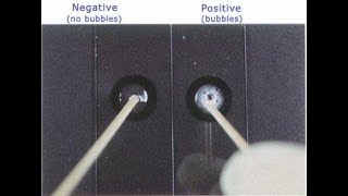 Catalase Test  How to perform [upl. by Finbur]