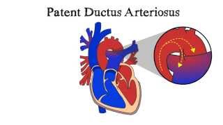 Aortic Arches Explained [upl. by Mohamed]