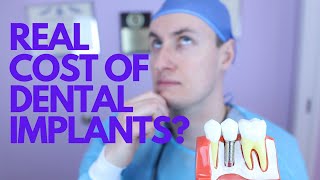 What is the cost of dental implants [upl. by Bennion]