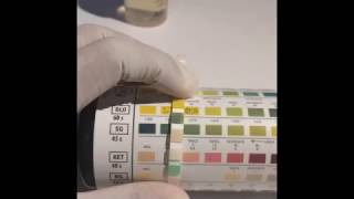 UTI dipstick test Urine Analysis [upl. by Lavicrep68]