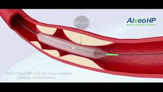 MaxPass Biliary Dilation Balloon InService [upl. by Abdul]