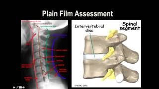 Cervical Spine XRay [upl. by Rawden]