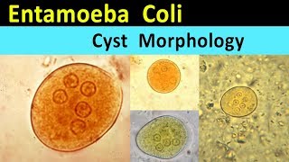 Entamoeba Coli Cyst Morphology [upl. by Irrok]