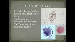 Parasitology Balantidiasis Part 2 [upl. by Yla]