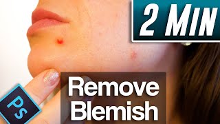 Photoshop 2021  How to Remove Blemishes and Acne Fast Tutorial [upl. by Meelas168]