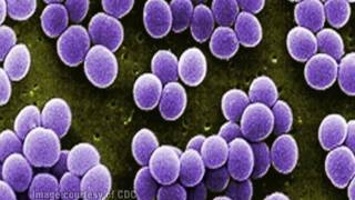 Staphylococcus aureus [upl. by Ennaitsirk]