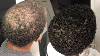 My 100 Natural HAIR GROWTH Serum  2 Month Update  GrowWithMe  Nia Hope [upl. by Asoral732]