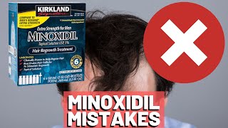 5 BIGGEST MISTAKES When Using Minoxidil REVEALED [upl. by Katt]