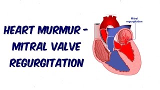 Mitral Regurgitation  Auscultation Sound [upl. by Mullane]