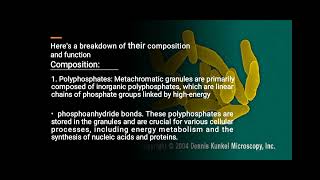 Metachromatic Leukodystrophy Explained [upl. by Wahs]