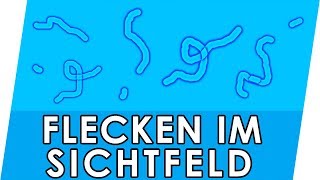 Flecken im Auge Was hilft gegen Mouches volantes fliegende Mücken amp Glaskörpertrübung [upl. by Ilesara247]