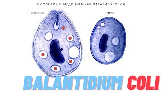 Балантидий Balantidium coli Балантидиаз [upl. by Ettenom]