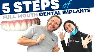 Full Mouth Dental Implant Procedure StepbyStep [upl. by Bullen]