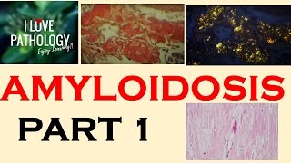 AMYLOIDOSIS Part 1 Definition Historical aspects amp Properties of Amyloid [upl. by Annavoig]