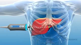 Organ Care System OCS™ Heart [upl. by Reggis]