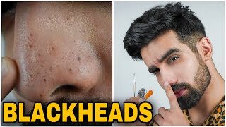 How To Remove BLACKHEADS at HomeEASY amp NATURALSkincare routineLarge Blackhead extraction Hindi [upl. by Eenttirb266]