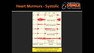 Heart Murmurs  Mitral and Tricuspid Regurgitation [upl. by Radman]