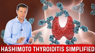 HASHIMOTOS THYROIDITIS Living with Autoimmune Disease [upl. by Dhaf]