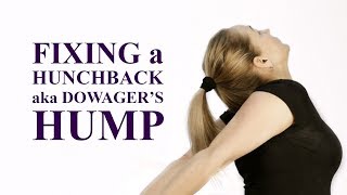 Fixing a Hunchback aka Dowager’s Hump How to Get Rid of a Neck Hump [upl. by Ramsay]