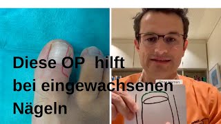 Hilfe bei eingewachsenen Zehenägeln [upl. by Catharina]