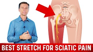 Best Stretches for Sciatica Nerve Pain Relief – Dr Berg [upl. by Uolymme659]