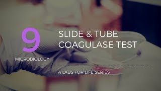 Slide and tube coagulase tests [upl. by Aggappera312]