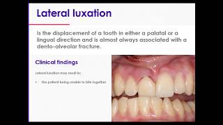 11 Traumatic Dental Injuries Part 2 Luxation Injuries Type 4 Lateral Luxations [upl. by Wildee452]