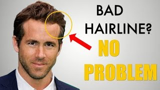 5 Awesome Hairstyles for Widows Peak  Receding Hairline [upl. by Adelaide]