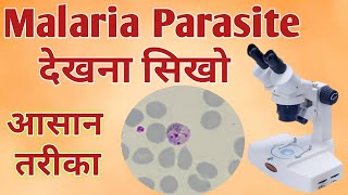 Malaria parasite under microscope  Malaria test  Malaria test procedure [upl. by Drallim17]