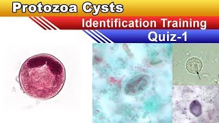 Protozoa Cysts Identification Training Quiz  Part 1 [upl. by Siddon722]