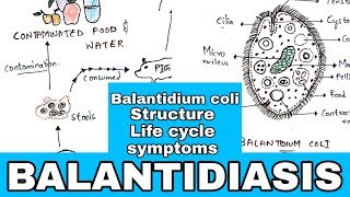 Balantidiasis  Balantidium coli Structure Life cycle Symptoms Medication  Bio science [upl. by Lud]