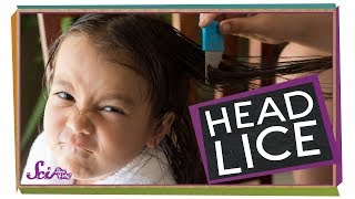 Head lice removal [upl. by Carboni75]