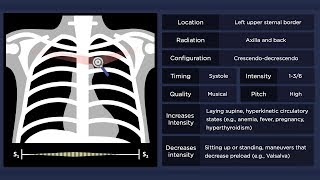 Pulmonary Flow Murmur [upl. by Zoie]