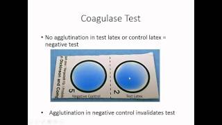 Identification of Staphylococcus [upl. by Herson901]