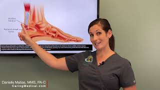 Treating Heel Bursitis and Achilles Tendinopathy with PRP Prolotherapy [upl. by Maxwell]